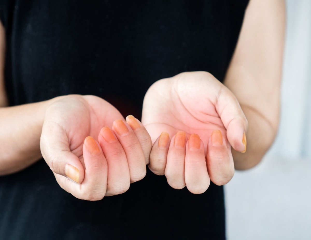 The Rising Allergy Epidemic in Nail Products: How to Stay Safe and Healthy - Hey Beautiful